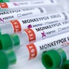 Amerika Serikat akan umumkan penambahan kasus cacar monyet setiap harinya