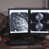 Percobaan Aberdeen AI bantu dokter kenali kanker payudara