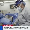 Orang pertama yang menerima transplantasi ginjal babi meninggal dunia