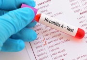 Komisi X DPR minta pemerintah gencarkan penelitian hadapi hepatitis misterius