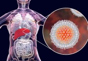 Ini 6 dugaan penyebab Hepatitis Akut