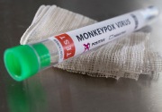 Ahli minta waspadai penyebaran cacar monyet lewat limbah medis
