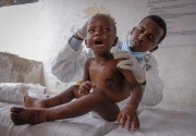SOS, ratusan orang mati karena kelaparan di Somalia