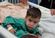 Operasi 7 jam, ahli bedah Saudi memisahkan kembar siam Suriah 