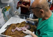 Keajaiban, dokter selamatkan bayi dari rahim ibunya yang dibunuh tentara Israel