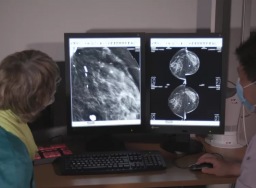 Percobaan Aberdeen AI bantu dokter kenali kanker payudara