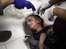 Dokter semakin sedikit, 60.000 warga Palestina sekarat: Apa ini bukan genosida?