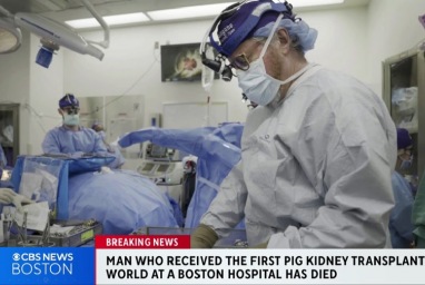 Orang pertama yang menerima transplantasi ginjal babi meninggal dunia