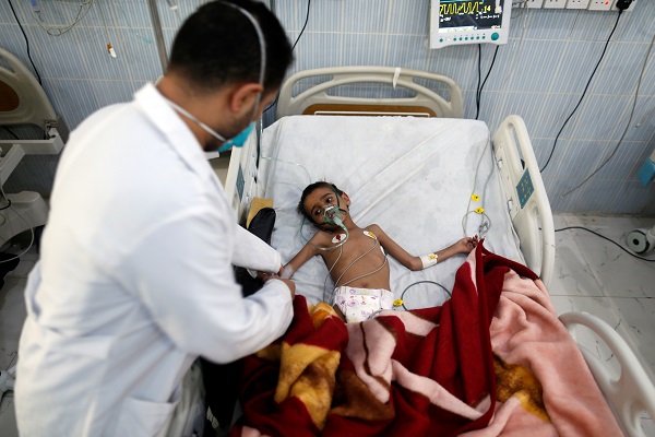 Darurat malnutrisi anak di Yaman