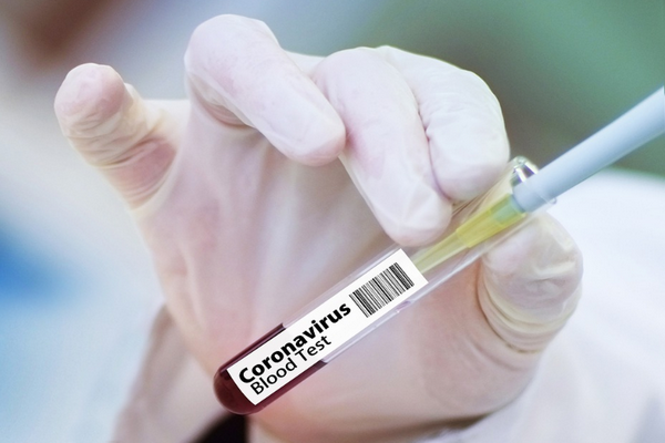Vaksin Covid-19 dari China harus aman