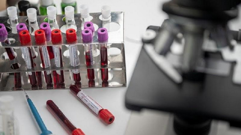 Lusa, Bio Farma mulai produksi vaksin Covid-19