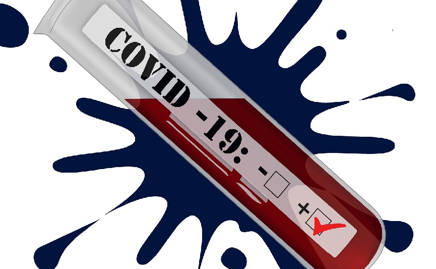 Update Covid-19 10 April: 1,56 juta positif, 1,40 juta sembuh, 42.443 meninggal