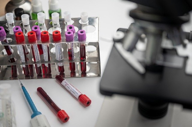Anhui akan kirim hingga 20 juta dosis vaksin Covid-19 ke RI