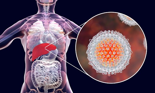 Ini 6 dugaan penyebab Hepatitis Akut