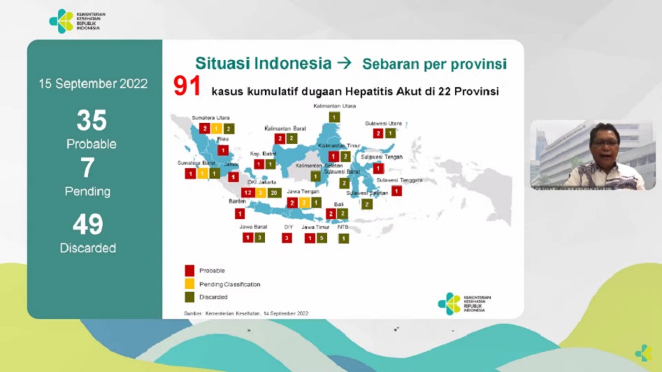 Kemenkes telah periksa 91 kasus dugaan hepatitis akut di 22 provinsi 