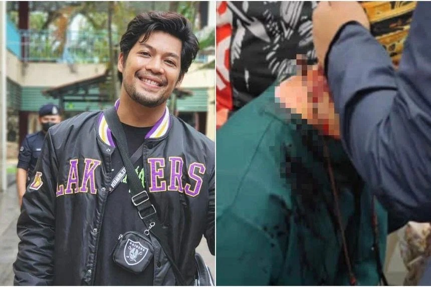 Aktor Malaysia jadi korban serangan berdarah saat jumpa fans di Singapura