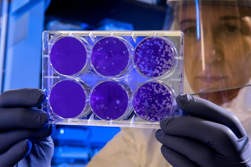 Ilmuwan Centers for Disease Control and Prevention (CDC) memeriksa hasil uji plak, yang merupakan tes untuk menghitung berapa banyak partikel virus flu dalam campuran./Foto CDC/Unsplash.com.