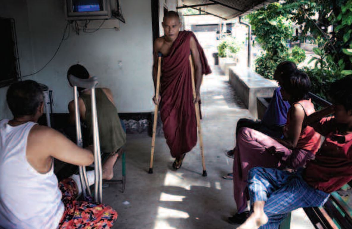  Seorang biksu yang ikut turun berunjuk rasa pada September 2007 tertembak. Kakinya harus diamputasi karena terinfeksi. /Foto dok. Human Rights Watch